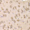 Eukaryotic Translation Elongation Factor 1 Beta 2 antibody, LS-C335690, Lifespan Biosciences, Immunohistochemistry paraffin image 