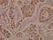 Rabphilin 3A antibody, A10247-1, Boster Biological Technology, Immunohistochemistry paraffin image 