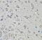 Cyclin-dependent kinase 10 antibody, FNab01551, FineTest, Immunohistochemistry paraffin image 