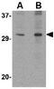 Dynein light chain 1, axonemal antibody, GTX85387, GeneTex, Western Blot image 