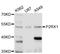 P2X purinoceptor 1 antibody, abx126991, Abbexa, Western Blot image 