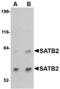 SATB Homeobox 2 antibody, MBS150603, MyBioSource, Western Blot image 