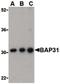 B Cell Receptor Associated Protein 31 antibody, PA5-20194, Invitrogen Antibodies, Western Blot image 