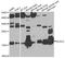 Neurocalcin Delta antibody, A8000, ABclonal Technology, Western Blot image 