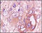 Chitinase 3 Like 1 antibody, 251464, Abbiotec, Immunohistochemistry paraffin image 