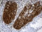 Chromosome Segregation 1 Like antibody, M04496, Boster Biological Technology, Immunohistochemistry paraffin image 