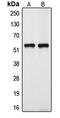 Cytochrome P450 Family 39 Subfamily A Member 1 antibody, GTX55953, GeneTex, Western Blot image 