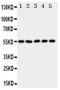 Hyaluronidase-2 antibody, PA1817, Boster Biological Technology, Western Blot image 