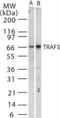 Tumor Necrosis Factor Receptor Associated Factor 3 antibody, NB100-56654, Novus Biologicals, Western Blot image 