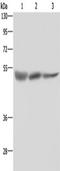 STK26 antibody, TA351413, Origene, Western Blot image 