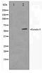 Keratin, type II cytoskeletal 8 antibody, TA347417, Origene, Western Blot image 
