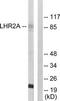 Von Willebrand Factor A Domain Containing 5A antibody, TA312370, Origene, Western Blot image 