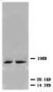 Cyclin Dependent Kinase Inhibitor 1B antibody, AP23264PU-N, Origene, Western Blot image 