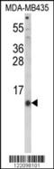 Hepcidin Antimicrobial Peptide antibody, 63-955, ProSci, Western Blot image 