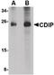 Cell Death Inducing P53 Target 1 antibody, PA5-20692, Invitrogen Antibodies, Western Blot image 