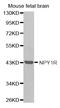 Neuropeptide Y Receptor Y1 antibody, TA327524, Origene, Western Blot image 