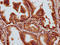 Multiple C2 And Transmembrane Domain Containing 2 antibody, LS-C680838, Lifespan Biosciences, Immunohistochemistry paraffin image 