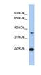 Fas apoptotic inhibitory molecule 1 antibody, NBP1-55209, Novus Biologicals, Western Blot image 
