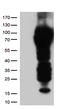CD5 Molecule antibody, LS-C796670, Lifespan Biosciences, Western Blot image 