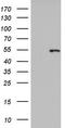 Keratin 14 antibody, CF803267, Origene, Western Blot image 