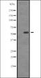 Serum/Glucocorticoid Regulated Kinase Family Member 3 antibody, orb335489, Biorbyt, Western Blot image 