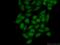 Chromodomain Helicase DNA Binding Protein 9 antibody, 13402-1-AP, Proteintech Group, Immunofluorescence image 