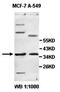 Zinc Finger Protein 177 antibody, orb77965, Biorbyt, Western Blot image 