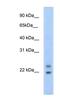 Cytoplasmic polyadenylated homeobox antibody, NBP1-91616, Novus Biologicals, Western Blot image 