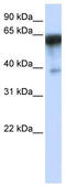 Kirre Like Nephrin Family Adhesion Molecule 1 antibody, TA342364, Origene, Western Blot image 