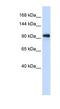 Exosome Component 10 antibody, NBP1-57184, Novus Biologicals, Western Blot image 