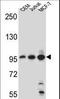 Aftiphilin antibody, LS-C156138, Lifespan Biosciences, Western Blot image 