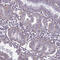 ITGB4 antibody, HPA036348, Atlas Antibodies, Immunohistochemistry paraffin image 