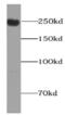 Protein PIEZO1 antibody, FNab06435, FineTest, Western Blot image 