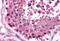MAGE Family Member F1 antibody, MBS241073, MyBioSource, Immunohistochemistry paraffin image 