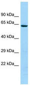 Keratin 74 antibody, TA331332, Origene, Western Blot image 