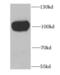 Glycogen Synthase 1 antibody, FNab03736, FineTest, Western Blot image 