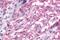 Glutamate Metabotropic Receptor 3 antibody, NLS899, Novus Biologicals, Immunohistochemistry paraffin image 