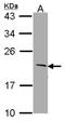 SERTA Domain Containing 1 antibody, NBP1-31052, Novus Biologicals, Western Blot image 