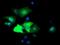 Epsin 2 antibody, MA5-25870, Invitrogen Antibodies, Immunocytochemistry image 