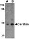 Estrogen Receptor 1 antibody, orb6021, Biorbyt, Western Blot image 