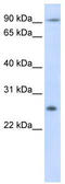 Tetraspanin 31 antibody, TA339030, Origene, Western Blot image 