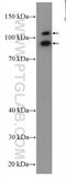 Ankyrin Repeat And BTB Domain Containing 2 antibody, 24323-1-AP, Proteintech Group, Western Blot image 