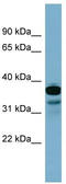 Adenylate Kinase 9 antibody, TA330963, Origene, Western Blot image 