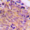 BAX antibody, LS-C353915, Lifespan Biosciences, Immunohistochemistry paraffin image 
