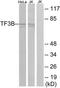 ZFP36 Ring Finger Protein Like 1 antibody, TA313986, Origene, Western Blot image 
