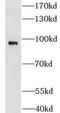 Glucosamine (N-Acetyl)-6-Sulfatase antibody, FNab03557, FineTest, Western Blot image 