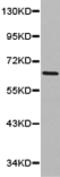 Sorting nexin-9 antibody, TA321851, Origene, Western Blot image 