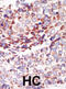 TEK Receptor Tyrosine Kinase antibody, abx033613, Abbexa, Immunohistochemistry paraffin image 