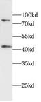 Androgen Receptor antibody, FNab10391, FineTest, Western Blot image 