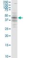 SLP-65 antibody, H00029760-M04, Novus Biologicals, Western Blot image 